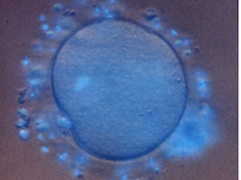 burrill-stemcell.jpg